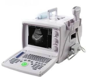 Portable Ultrasound Scanner with Convex Probe - S9618